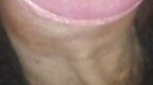 19-year-old boy's penis with a pink head