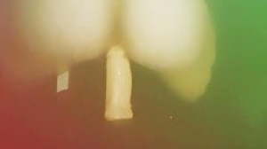 Anal self care