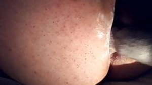 Anal