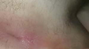 asshole after heavy anal